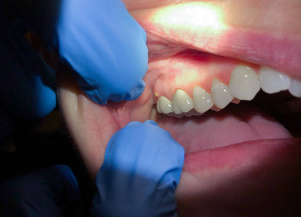 Best Emergency Dental Services Near Me  in Algonquin, MD